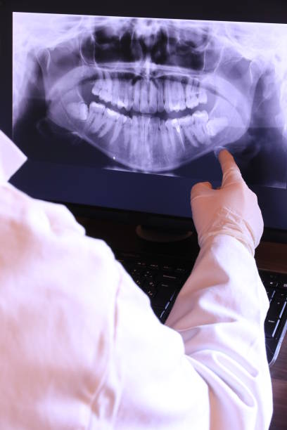 Best Emergency Wisdom Tooth Extraction in Marietta, OK
